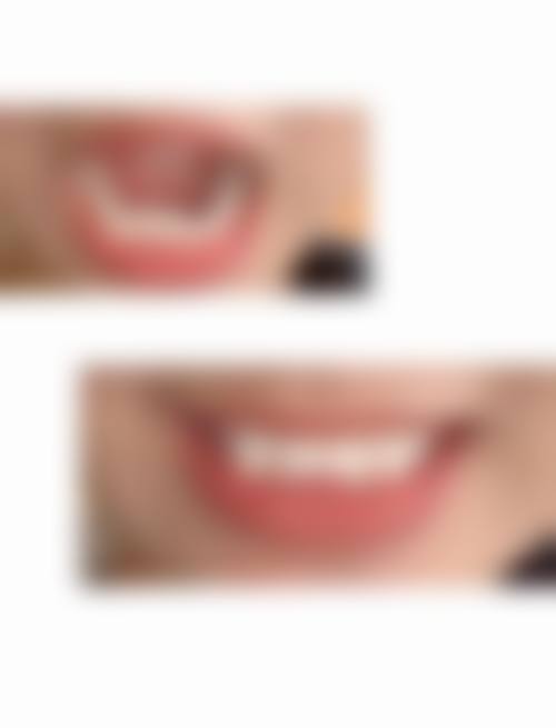 运城嘉悦周颖口腔牙冠品牌及价格 1680，高品质牙冠低价享，性价比远超同行！之预约挂号方式