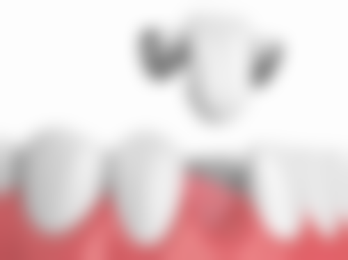 叶丽萍医生技术特点