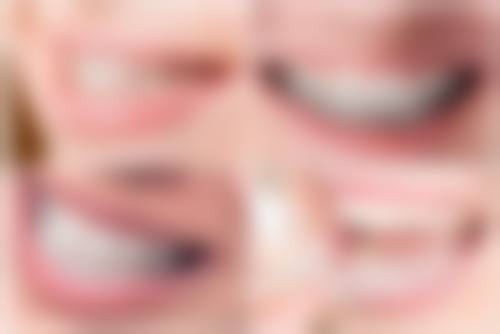 杭州博凡口腔陈璐璐医生怎么预约挂号