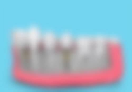 运城嘉悦周颖口腔美国皓圣种植的成功实例