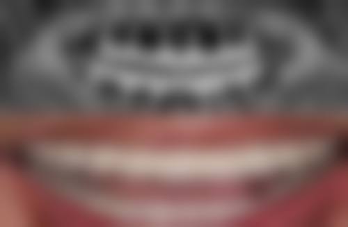 冯晶晶医生技术特点