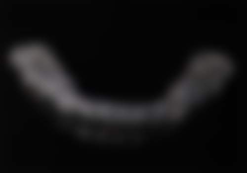 运城嘉悦周颖口腔正雅隐形矫正的技术优势