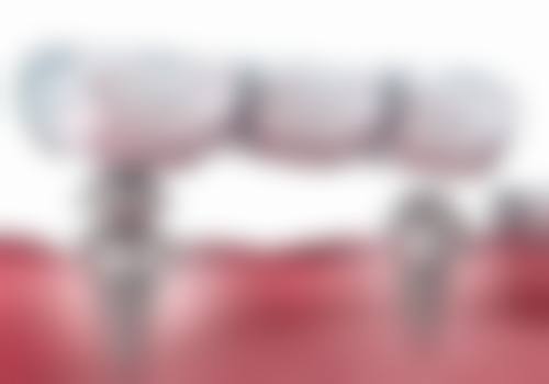 山东烟台刁江荣口腔诊所预约挂号方式