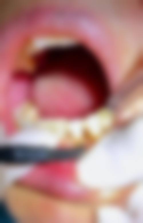 陕西商洛牙管家口腔地址及乘车路线:轻松找到目的地