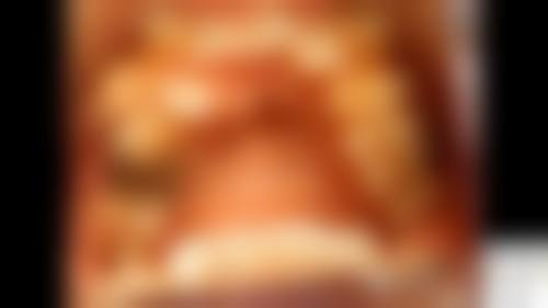 牙克石益安口腔门诊部真实实例