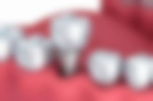 吴树华口腔营业时间:方便你的就诊安排