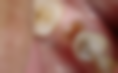 邳州市合美口腔口碑怎么样