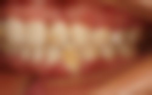 钟童医生真实实例