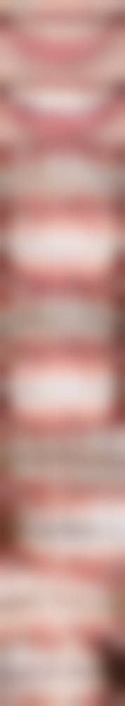 连云港华美整形门诊部(口腔科)真实实例