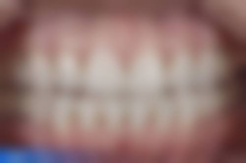 湖南长沙牙圣口腔(新华联店)预约挂号方式