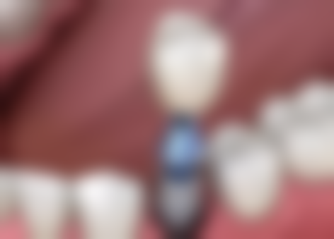 北京冠美平乐口腔门诊口碑怎么样：患者真实评价见分晓