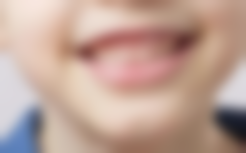 拔牙是把牙根也拔掉吗？别纠结！专业解读拔牙时牙根处理真相，让你拔牙不再迷茫！ 