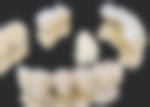 补牙后吃辣的时间受哪些因素影响