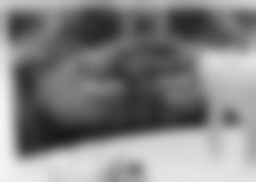 佳木斯市中 心医院肾内科鲍江波医生擅长项目