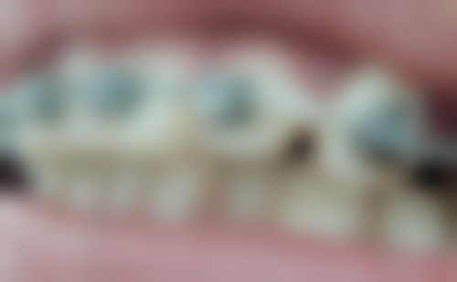 张稀稀医生荣誉资质