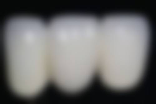 根尖周炎做根管治疗值不值?