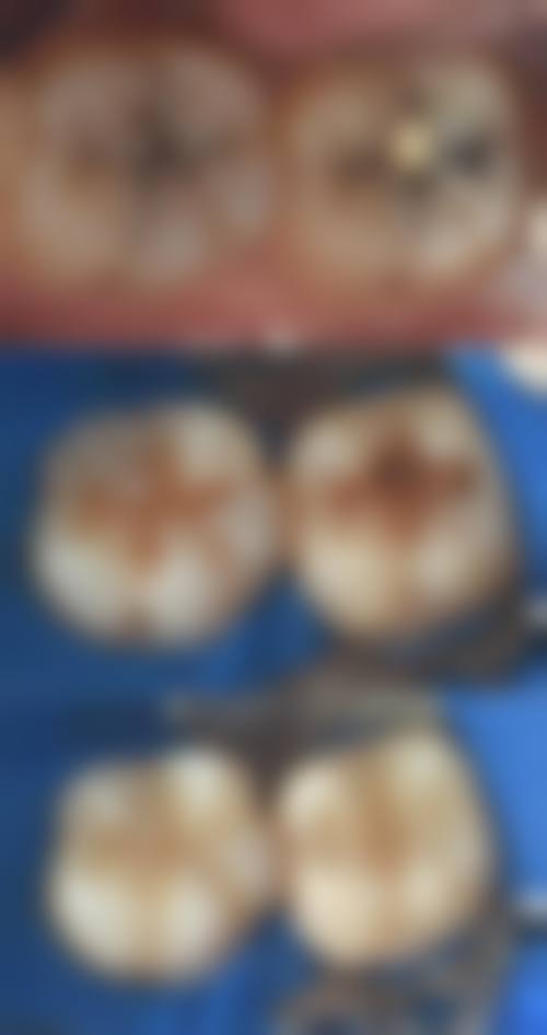 广州牙邦邦口腔诊所口碑怎么样