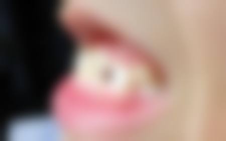 和平爱之祥口腔门诊部价格表：合理透明超划算