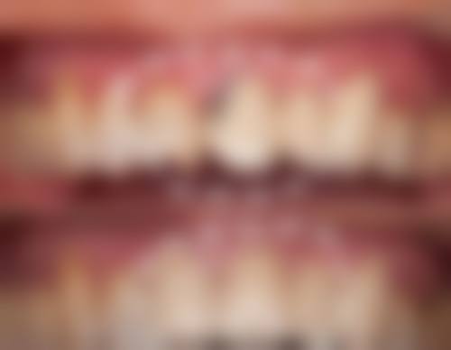 深圳丹妮口腔门诊部真实实例