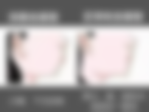 根管治疗后不做牙冠牙齿折裂的概率大吗