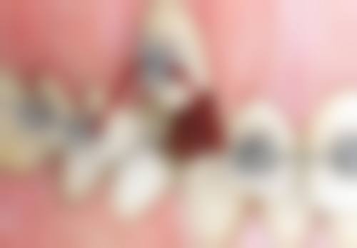 东莞南城爱芽口腔电话号码：随时询问不等待