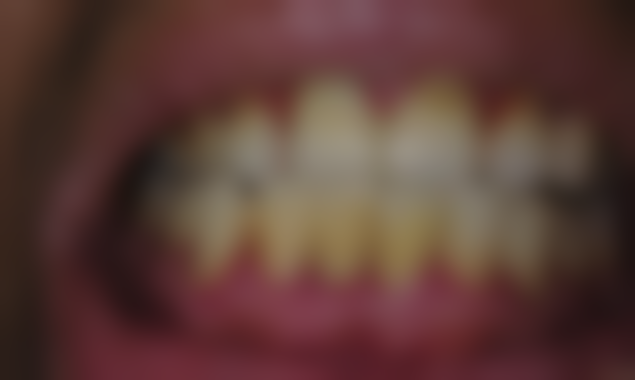 黄李鑫辉医生口碑评价