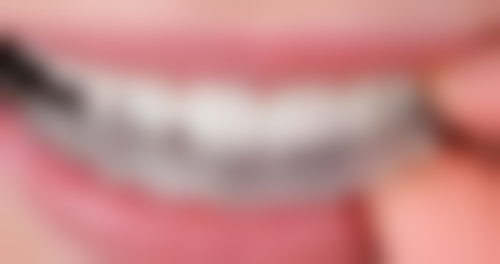 有烤瓷牙做牙齿矫正的条件是什么