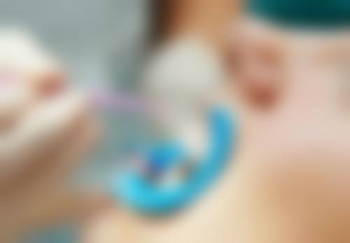 有烤瓷牙能做腰部核磁共振检查吗？权威揭秘：多数情况可做，仅含金属烤瓷牙需先拆除！ 