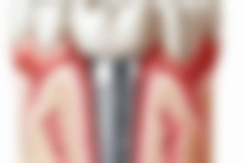 西安未央海涛口腔门诊(广安分院)口碑怎么样