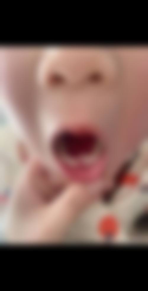 山东泰安肥城肖敏口腔真实实例