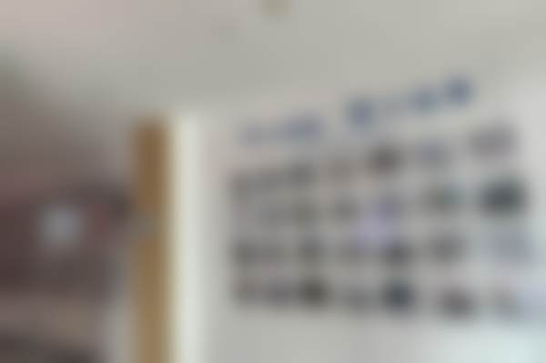 西宁中诺口腔医院张娜医生做种植牙靠谱吗