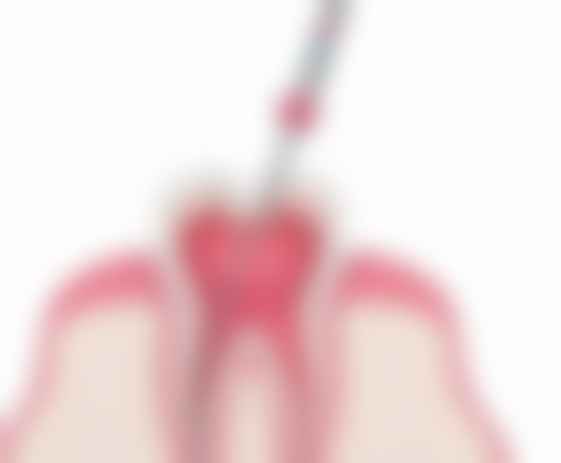 朱华磊医生真实实例:成效看得见