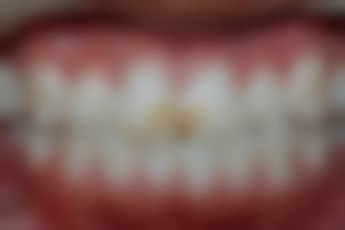 北京京大博爱口腔门诊部刘婧2026坐诊挂号值不值