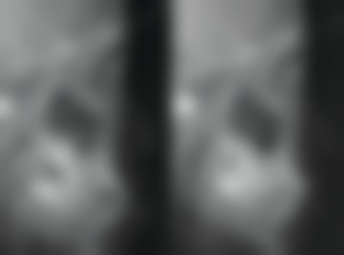 运城嘉悦周颖口腔门诊部周颖医生的治疗成效值不值