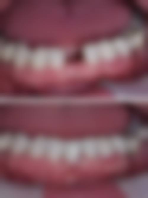 重庆牙博士合川口腔诊所真实实例:见证神奇的改变