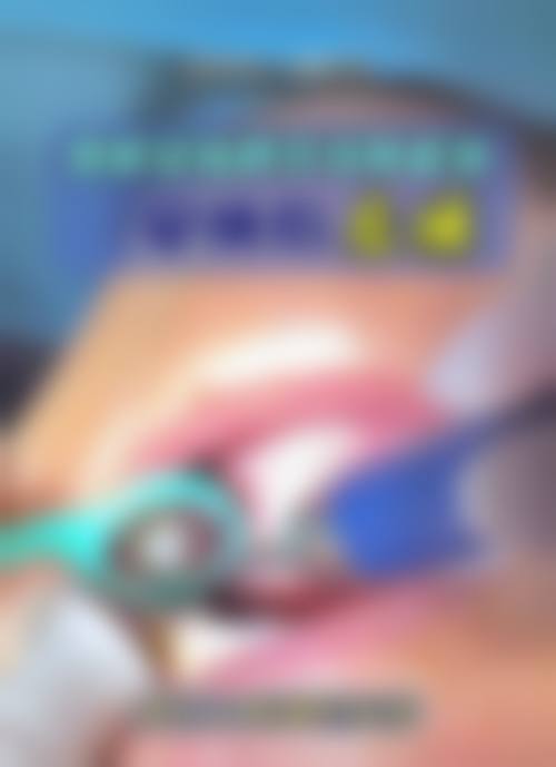 赣州欧菲口腔价格表