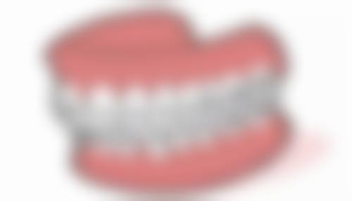 赣州爱牙仕口腔真实实例：见证神奇改变