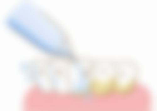 山西太原可睦口腔擅长项目