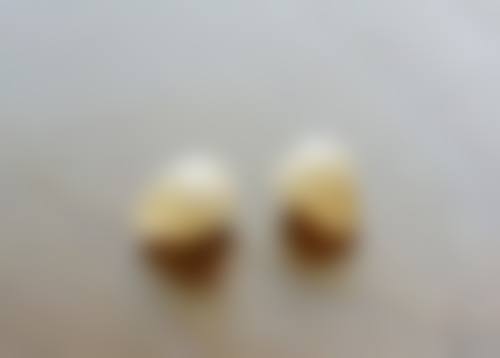 浙江温州瑞安叶阿波口腔真实实例：见证口腔奇迹的发生