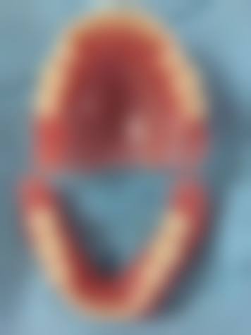 浙江温州瑞安叶阿波口腔仪器设备：科技助力口腔健康