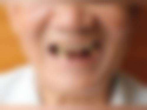 浙江温州瑞安叶阿波口腔价格表：合理收费，性价比极高