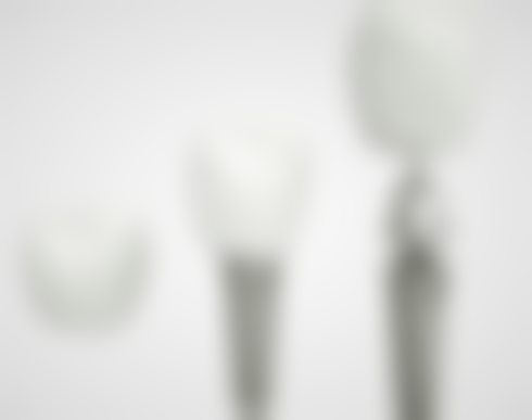 浙江温州瑞安叶阿波口腔擅长项目：全方面的口腔解决方案