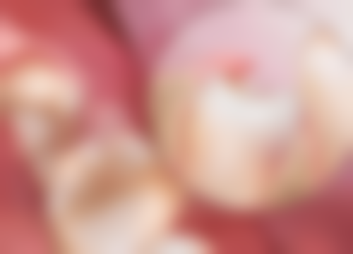 老年人需要做种植牙吗？告诉你，种牙能改善咀嚼功能、提升生活质量，好处多多别错过！ 