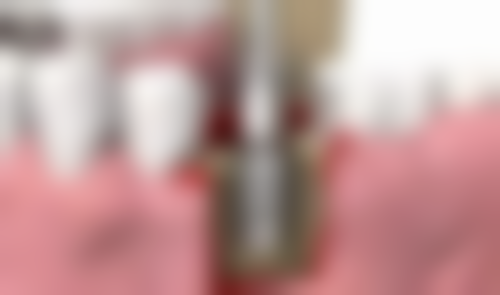 内蒙古赤峰市福汇口腔门诊部口碑怎么样