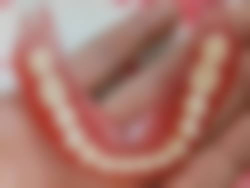 拔牙报职工医疗保险的条件怎么样