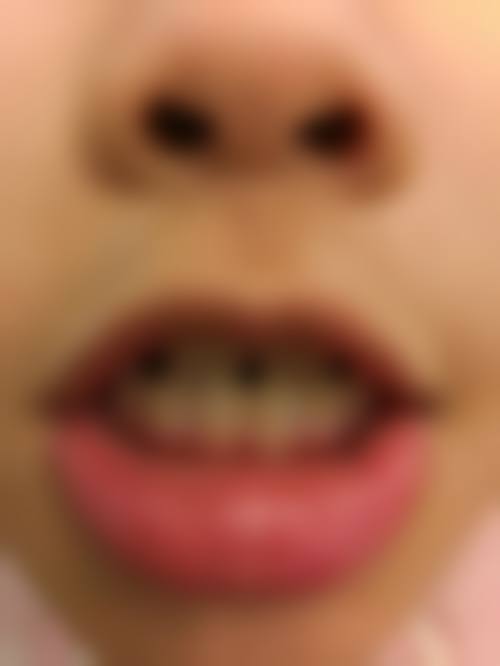 武汉青山金坤口腔门诊部预约挂号方式