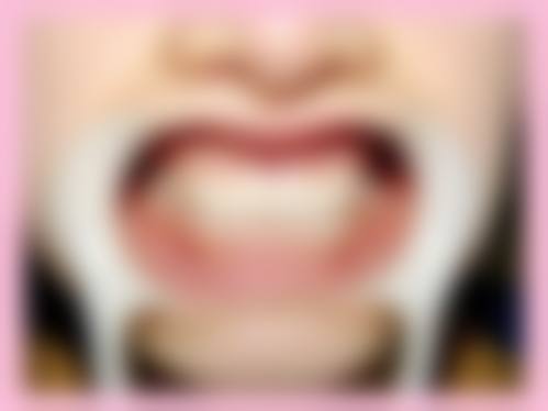 重庆医药高等专科学校附属第一医院口腔科预约挂号方式