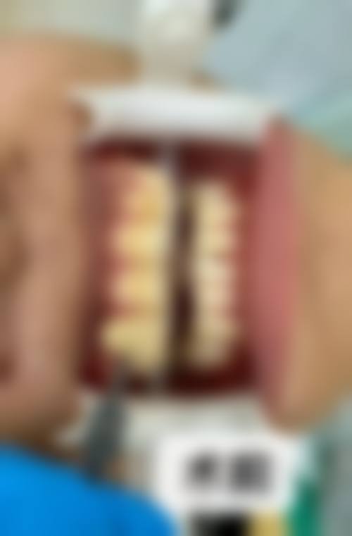 宣城郎溪县益齿口腔口碑怎么样