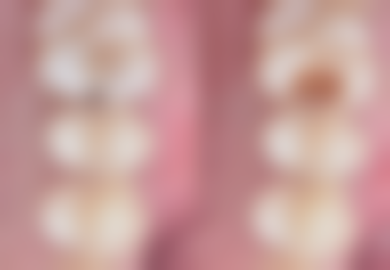 刘婧医生的真实实例