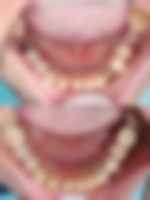 桂林美皓（美奥）口腔门诊部预约挂号方式